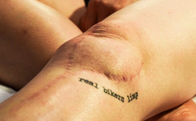 Scars: Memories of the Skin